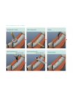 Набор для расщепления гребня Bone Expander Kit